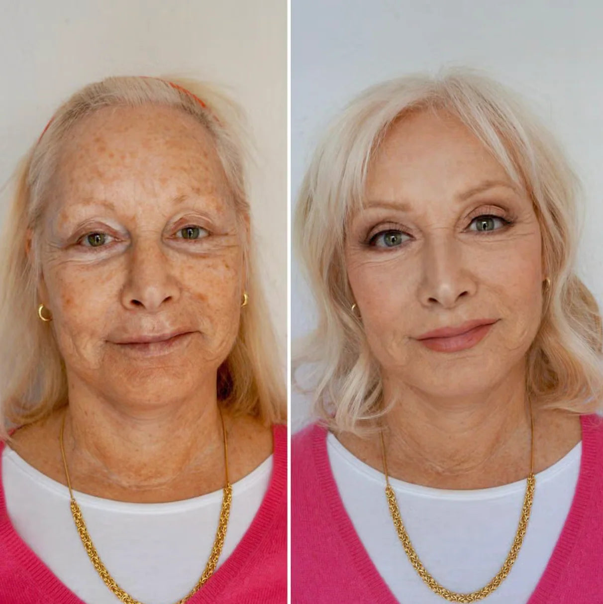 GlowPlus® 5-in-1 Collagen Peptide Complex